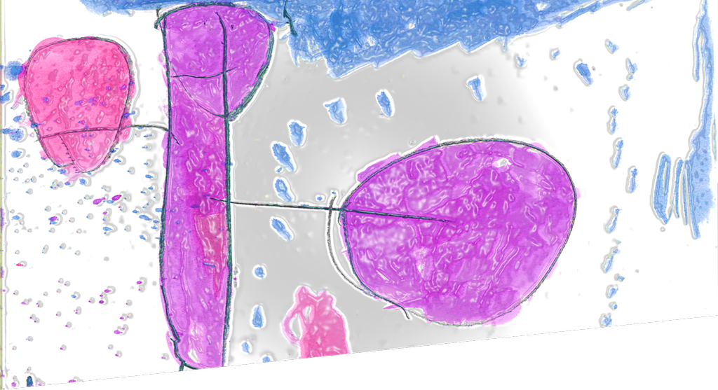 Målad bild. Från vänster i bild: En rosa cirkel, sedan en lila rektangel ståendes, blåa prickar utspritt i bilden. I mitten en stor lila cirkel.